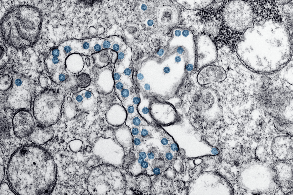 The Breast Microbiome & Maternal-Infant Health: Dysbiosis, Mastitis, and the Tools to Support Balance - Legendairy Milk